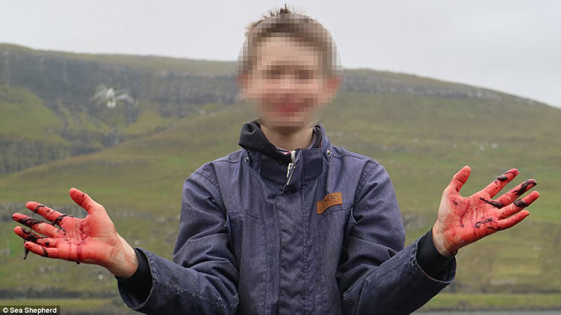 Cả vùng nước chuyển đỏ vì máu: Thảm cảnh hàng ngàn chú cá voi hoa tiêu bị giết hại, xả thịt dã man bên bờ biển